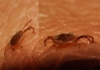 Erythraeidae