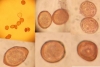 Gymnosporangium clavariiforme (Wulfen) DC. 1805