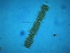 Diatomea."Fragilaria sp"